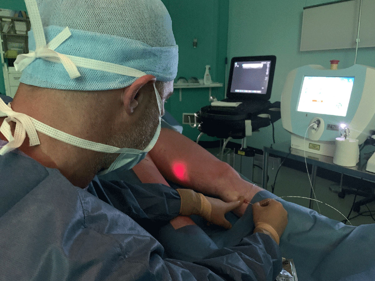 INSUFFISANCE VEINEUSE